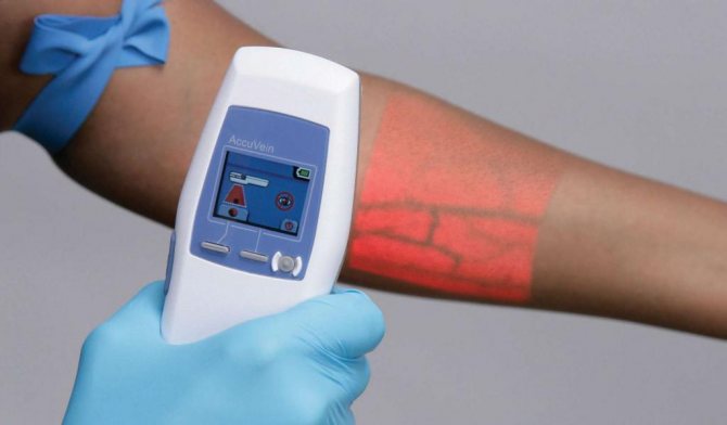 medical devices with infrared rays