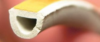 Izolarea ferestrelor din plastic pentru bricolaj - lipiți izolarea autoadezivă pentru ramele ferestrelor 3